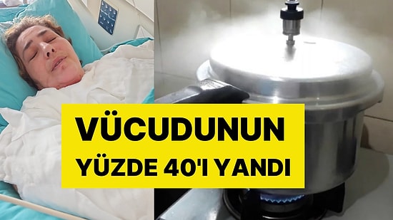 Düdüklü Tencere Patladı, Az Kalsın Ölüyordu: Vücudunun Yüzde 40'ı Yandı