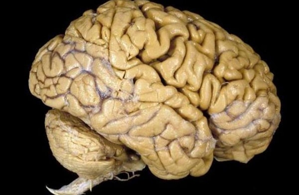 Record for Consuming the Most Cow Brains: The record belongs to a person who consumed a total of 57 cow brains.