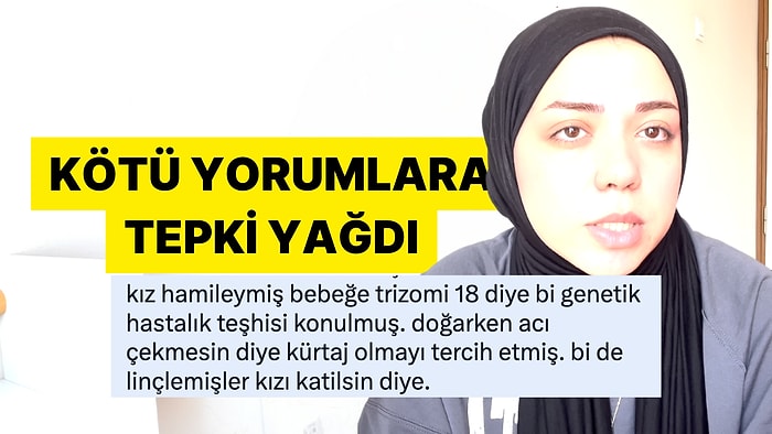 Sendromlu Çocuğunu Aldırdığı İçin Kötü Yorumlar Alan Anneye Destek Sosyal Medyadan Geldi