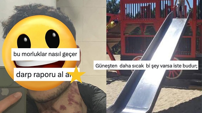 Boyundaki Seviştim Morluğundan Metal Kaydırak Travması Yaşayanlara Son 24 Saatin Viral Tweetleri