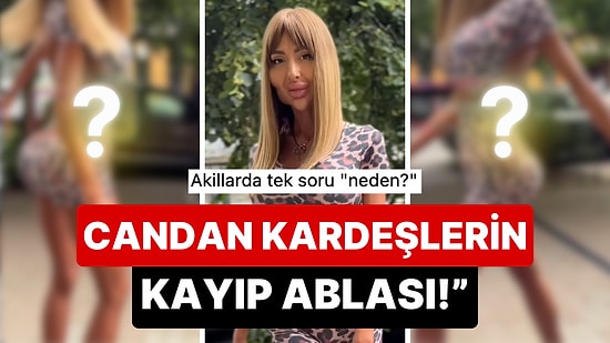 Dünyanın En Büyük Elmacık Kemiğine Sahip Anastasia Pokreshchuk, Bu Sefer Kalça Estetiği İçin Türkiye'ye Geldi