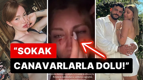 Danla Bilic "Öldüresiye Dövüldüm" Diyen Mika Raun'un Saldırı Sonrası Kanlar İçindeki Haline Kayıtsız Kalmadı!