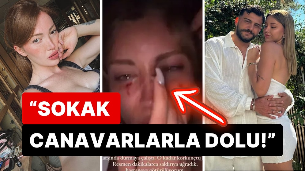 Danla Bilic "Öldüresiye Dövüldüm" Diyen Mika Raun'un Saldırı Sonrası Kanlar İçindeki Haline Kayıtsız Kalmadı!