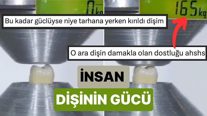 Bu Nasıl Olabilir? İnsan Dişinin Ne Kadar Güçlü Olduğu Bir Makine ile Ölçüldü