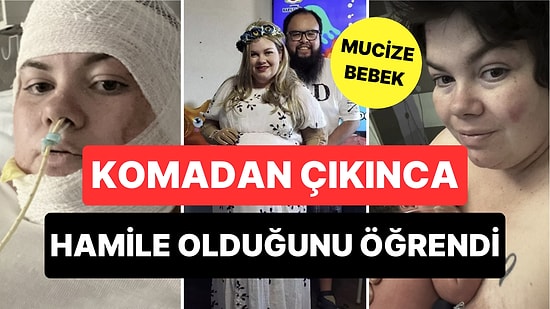 Mucize Bebek: Vücudunun Yarısı Yanan Kadın Komadan Çıkınca Hamile Olduğunu Öğrendi