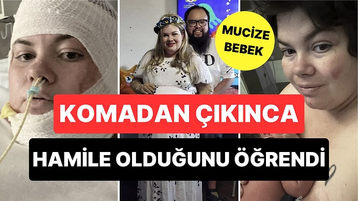 Mucize Bebek: Vücudunun Yarısı Yanan Kadın Komadan Çıkınca Hamile Olduğunu Öğrendi