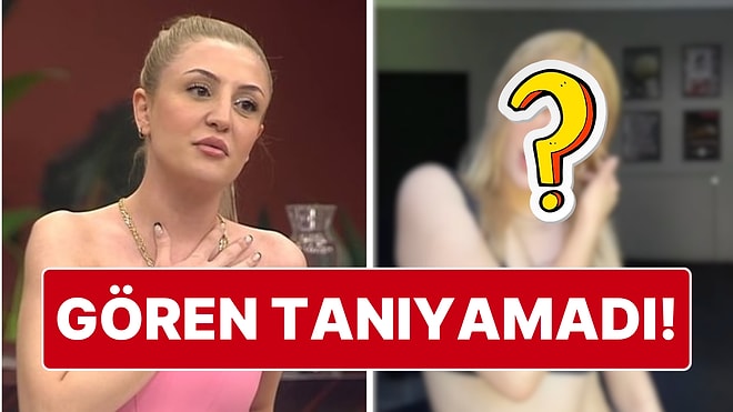 Ne Gerek Vardı? Eski Kısmetse Olur Yarışmacısı Tuğçe Aleyna Estetikle Tanınmaz Hale Geldi!