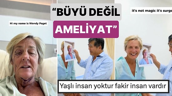 Artık Yaşlanmak Tarihe Karıştı: Bir Doktor 59 Yaşındaki Hastasının Operasyondan Sonraki Değişimini Paylaştı