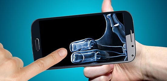 Smartphones May Soon Have X-Ray Imaging Capability Thanks to New Chip Technology