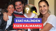 İbrahim Tatlıses'in Eski Eşi Derya Tuna Yüz Gerdirme İşlemi Sonrası Bambaşka Biri Oldu!