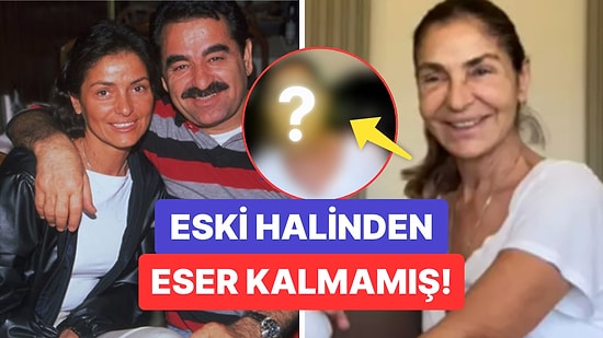 İbrahim Tatlıses'in Eski Eşi Derya Tuna Yüz Gerdirme İşlemi Sonrası Bambaşka Biri Oldu!