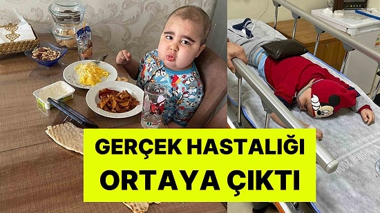 Yanlış Teşhis Yüzünden 2,5 Yıl Kemoterapi Gördü: Gerçek Hastalığı Ortaya Çıktı