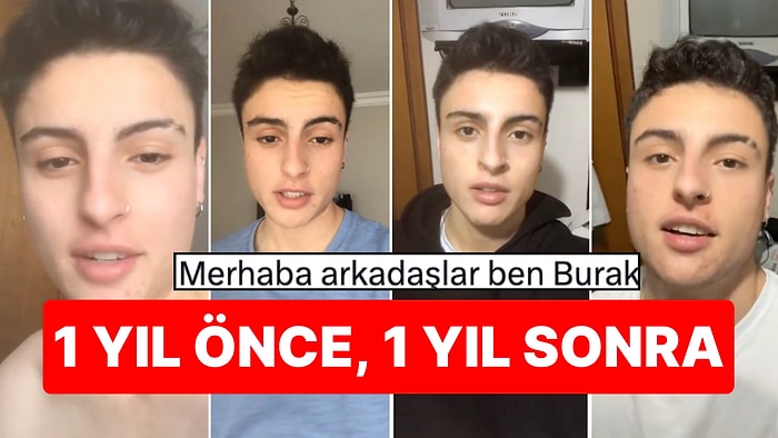 "Merhaba Arkadaşlar Ben Burak" Deyip Paylaştı: 1 Yıldır Hormon Alan X Kullanıcısının Değişimi