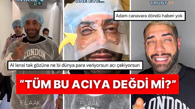 Her Geçen Gün Daha da İnandırıcı Oluyor: Göz Rengini Değiştiren Adamın Ameliyat Süreci