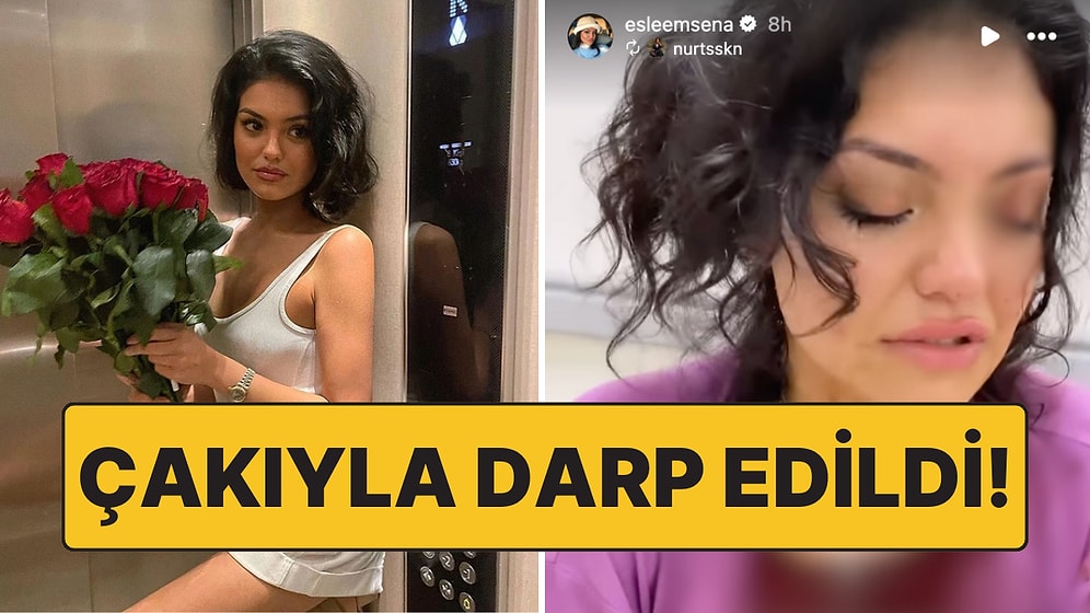 Kısmetse Olur Yarışmacısı Eslem Sena Nur, Eğlendiği Mekanda 3 Kadının Saldırısına Uğradı!