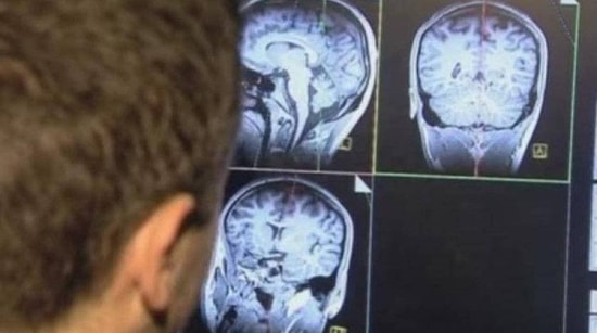 Child Receives Brain Implant to Reduce Epileptic Seizures by 80%