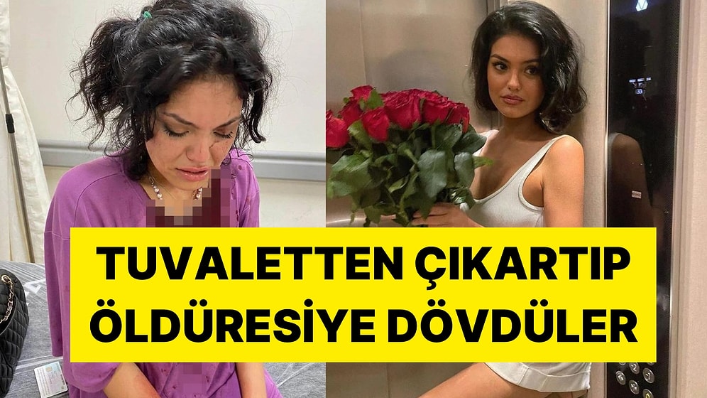 Saldırıya Uğrayan Kısmetse Olur Yarışmacısı Eslem Sena Nur: "Kafama Çakı Soktular"