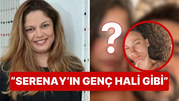 Yüzündeki İzlerden Eser Kalmamış: İzel'in İnanılmaz Değişimi Serenay Sarıkaya'ya Benzetildi!