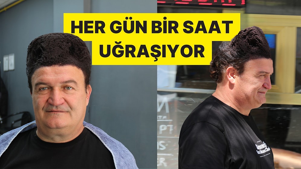 Dökülen Saçlarına Bulduğu Formülle "Kalpaklı" Lakabını Aldı
