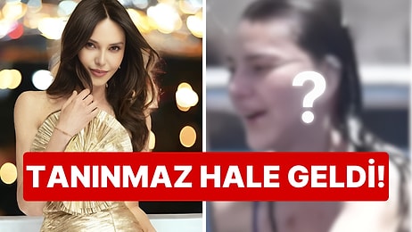 "Sıkıntıdan Estetik Yaptırıyorlar" Demişti: Hande Ataizi 2 Milyon TL Değerinde Bir Yüz Gerdirme İşlemi Geçirdi