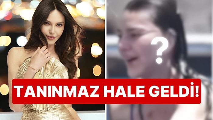 "Sıkıntıdan Estetik Yaptırıyorlar" Demişti: Hande Ataizi 2 Milyon TL Değerinde Bir Yüz Gerdirme İşlemi Geçirdi