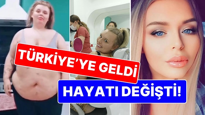 Türkiye'ye Geldi, Hayatı Değişti: Mide Küçültme Ameliyatından Sonra Bambaşka Biri Oldu!