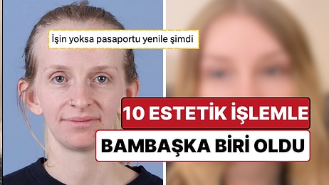 10 Estetik İşlem Birden Yaptıran Kadın, Son Haliyle Bambaşka Bir Yüze Sahip Oldu