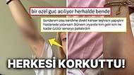 Yeni Fobimiz Hayırlı Olsun: Kollarında Durduk Yere Çıkan Morlukları Paylaşan Kullanıcı Tartışma Yarattı