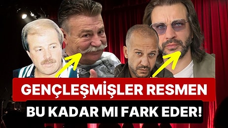 Gençleşmişler Resmen: Protez Saçlarıyla Bambaşka Birine Dönüşen Ünlü Erkeklerin Eski ve Yeni Halleri!