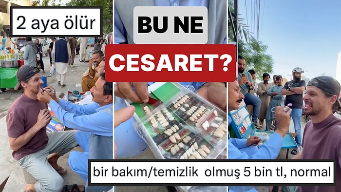 Bu Ne Cesaret? Bir Turist Pakistan'ın Meşhur Sokak Dişçilerinde Dişlerini Beyazlattırdı
