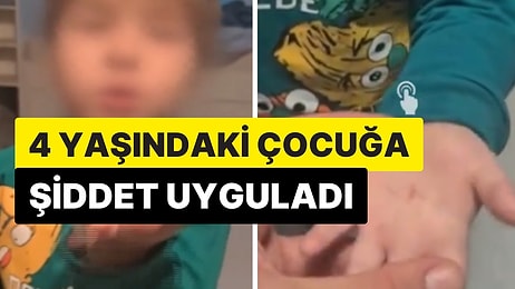 Balıkesir'deki Kreşte Bir Öğretmen  Çocuğa Şiddet Uyguladı: Eline Tırnaklarını Geçirdi