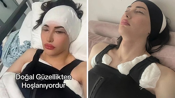 Gerçekten uzun ve ağır bir geçiş süreci geçiren Bektaş, tüm anlarını TikTok hesabından paylaşmıştı hatta.