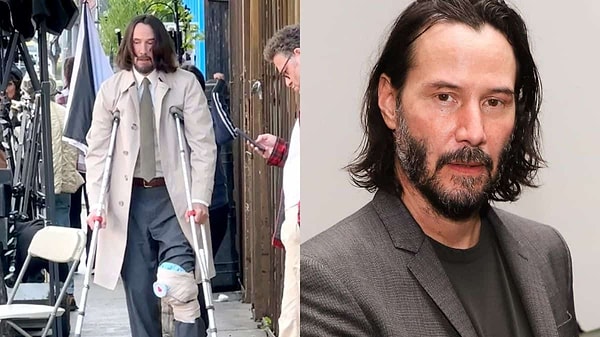 Keanu Reeves' knee was very swollen from the accident, and he joked, saying "Comedy is really hard, man."