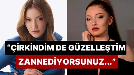 Danla Bilic'in Kötü Estetiklerinden Kurtularak Şimdiki Haline Geldiğini Söylemesi "Şaka mı Yapıyor?" Dedirtti