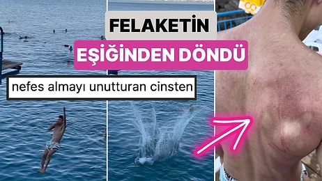 Serinlemek İçin Suya Atlayan Bir Genç Yanlış Atlayış Yapınca Felaketin Eşiğinden Döndü