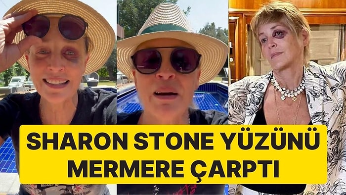 Sharon Stone Antalya'da Kaldığı Otelde Yüzünü Mermere Çarptı: 'Mermerin Halini Görmelisiniz'