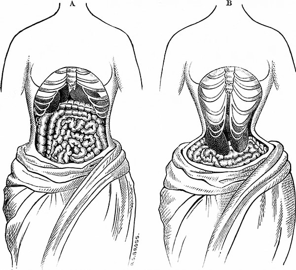 19'uncu yüzyıl Avrupa'sında tercih edilen korseler neredeyse iç çamaşırları kadar popüler bir 'göğüs büyütme' yöntemi olarak kullanılıyordu.