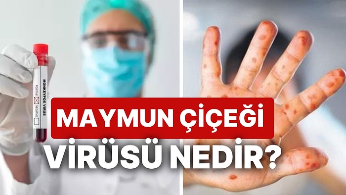 Maymun Çiçeği Virüsü Nedir? Maymun Çiçeği Hastalığı Nasıl Bulaşır, Belirtirleri Nelerdir?