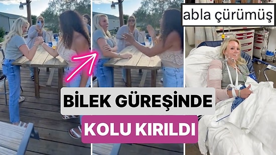 Bu Nasıl Mümkün Olabilir? Bir Kadın Arkadaşıyla Bilek Güreşi Yaparken Kolu Feci Şekilde Kırıldı