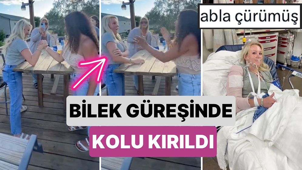 Bu Nasıl Mümkün Olabilir? Bir Kadın Arkadaşıyla Bilek Güreşi Yaparken Kolu Feci Şekilde Kırıldı
