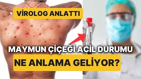 Virolog Açıkladı, Maymun Çiçeği Virüsünden Endişelenmeli miyiz? DSÖ Neden Acil Durum İlan Etti?