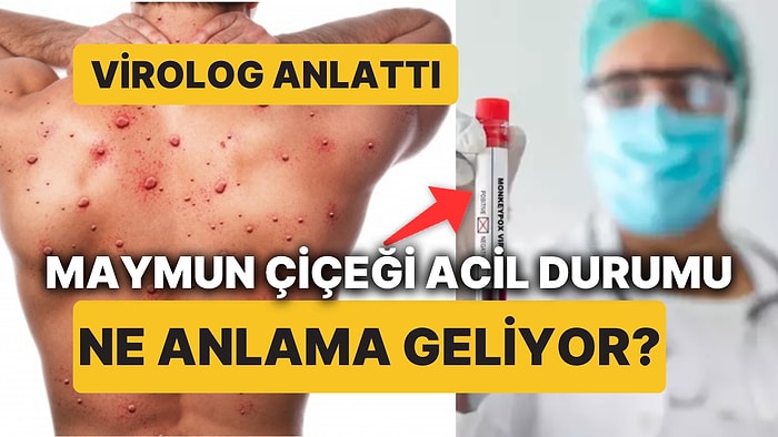 Virolog Açıkladı, Maymun Çiçeği Virüsünden Endişelenmeli miyiz? DSÖ Neden Acil Durum İlan Etti?