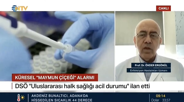 Prof. Dr. Önder Ergönül, Maymun Çiçeği Virüsü ile ilgili ülkemizeki durumu anlattı.