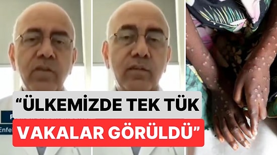 Prof. Dr. Önder Ergönül Ülkemizde Maymun Çiçeği Virüsü Hakkındaki Son Durumu Anlattı