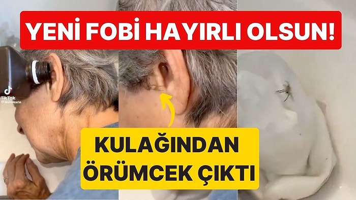 Yeni Fobi Hayırlı Olsun: İlginç Sesler Duyduğunu Söyleyen Kadının Kulağından Örümcek Çıktı