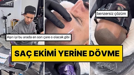 Saç Ekimi Yerine 120 Bin TL’ye Dövme Yaptıran Adam Sosyal Medya Gündeminde