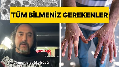 Virolog Dr. Semih Tareen Maymun Çiçeği Virüsüyle İlgili Bilinmesi Gerekenleri Anlattı