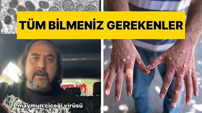 Virolog Dr. Semih Tareen Maymun Çiçeği Virüsüyle İlgili Bilinmesi Gerekenleri Anlattı