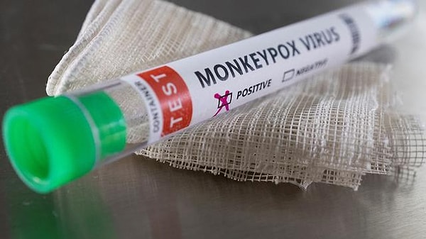 The Monkeypox virus was first identified in 1958 following research!