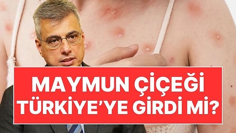 Sağlık Bakanı Memişoğlu'ndan Açıklama: Türkiye'de Maymun Çiçeği Vakası Görüldü mü?